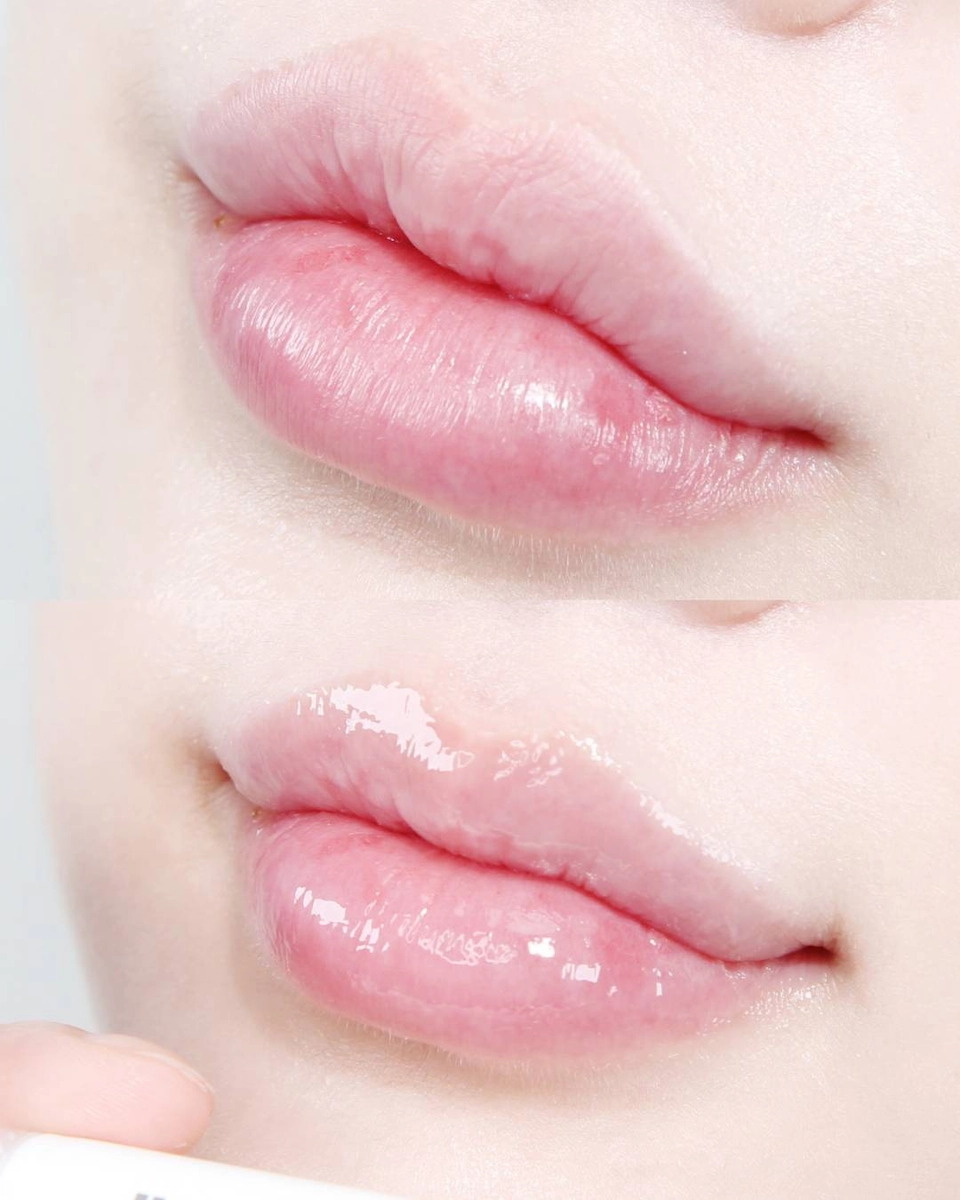 leaders-cosmetics-pdrn-lip-balm-review-12