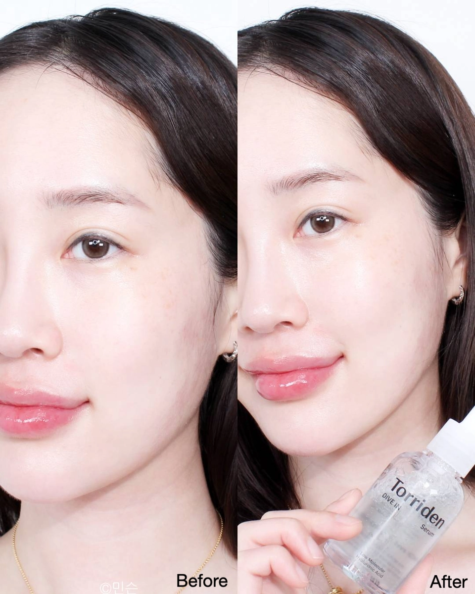 torriden-dive-in-serum-review-13