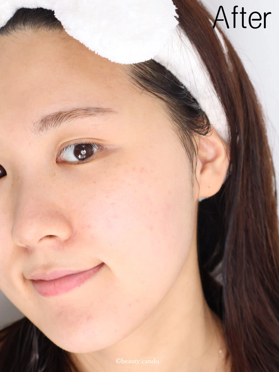 vegan-perfect-blue-barley-gel-cleanser-review-14