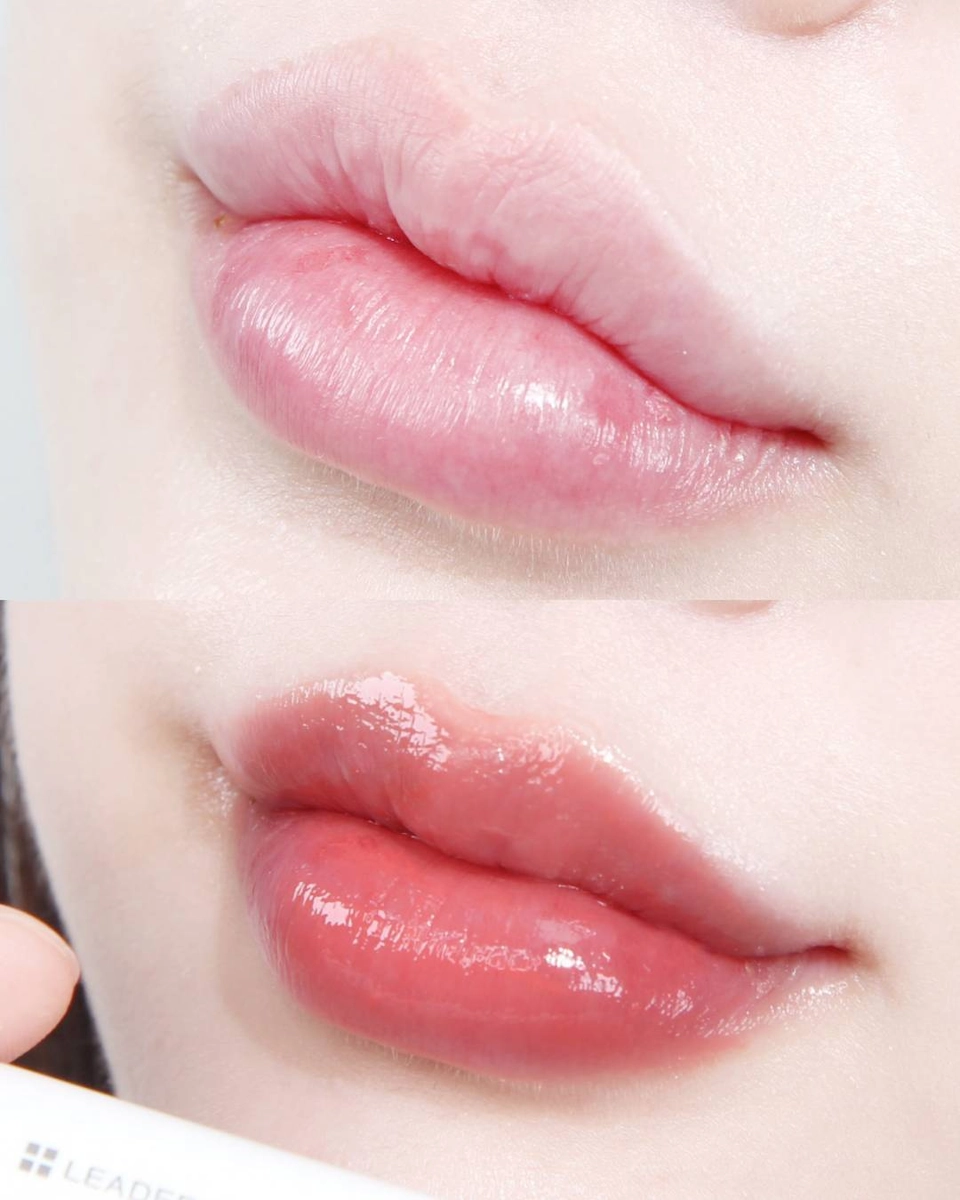 leaders-cosmetics-pdrn-lip-balm-review-16